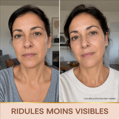 Sérum Éclat Immédiat PDRN - Skincare Coréenne BioChroma