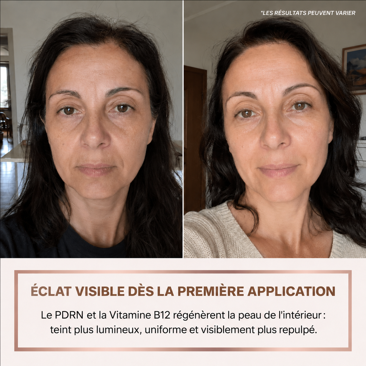 Sérum Éclat Immédiat PDRN - Skincare Coréenne BioChroma