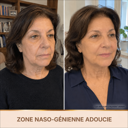 Sérum Éclat Immédiat PDRN - Skincare Coréenne BioChroma