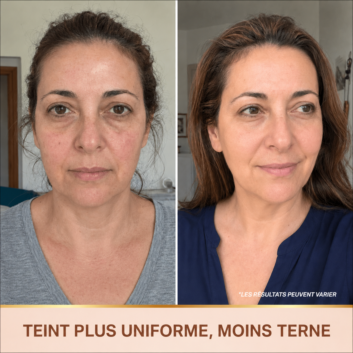 Sérum Éclat Immédiat PDRN - Skincare Coréenne BioChroma