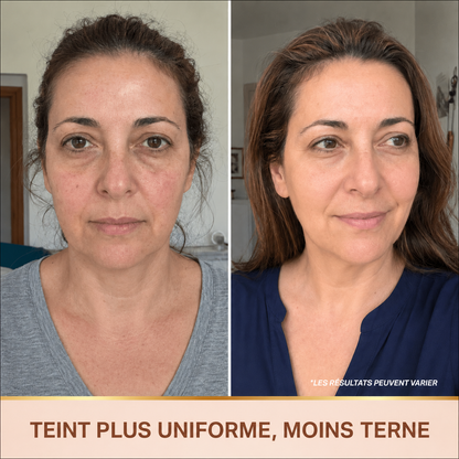Sérum Éclat Immédiat PDRN - Skincare Coréenne BioChroma