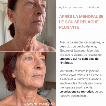 Crème Cou Liftante & Raffermissante - BioChroma