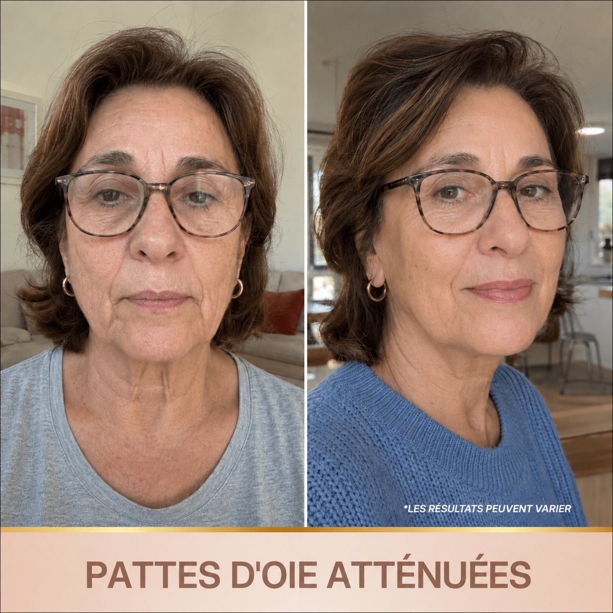 Sérum Éclat Immédiat PDRN - Skincare Coréenne BioChroma